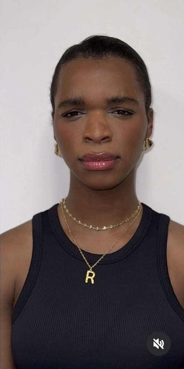 After Image: Botox Full Face - front