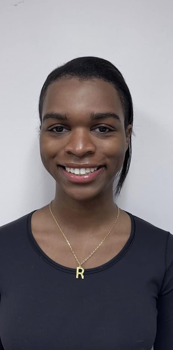 Before Image: Botox Full Face - front