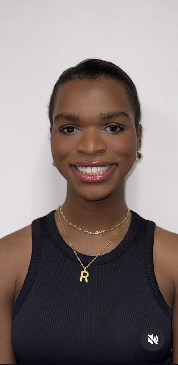 After Image: Botox Full Face - front