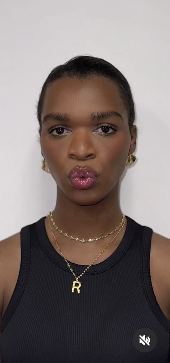 After Image: Botox Full Face - front