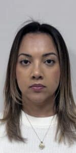 Before Image: Botox Full Face