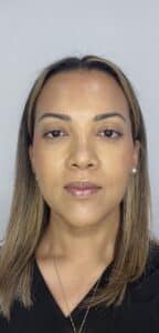 After Image: Botox Full Face